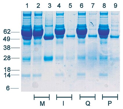 Depletion Profile: Rabbit Serum (50 µL) diluted with PBS was incubated with Protein G magnetic beads per manufacturer’s instructions.  The depleted rabbit serum samples were separated by SDS-PAGE and the gel stained with Coomassie Blue using Millipore and competitor magnetic beads.  Lane 1: input material, lanes 2, 4, 6, 8: depleted samples, lanes 3, 5, 7, 9: eluted samples.